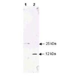 Western Blot - Anti-TGF beta 1 Antibody (A283195) - Antibodies.com
