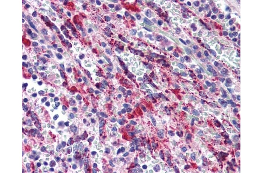 Immunohistochemistry - Anti-TGF beta 1 Antibody (A283195) - Antibodies.com