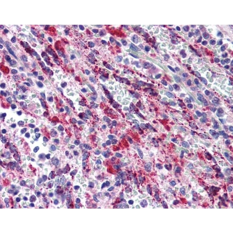 Immunohistochemistry - Anti-TGF beta 1 Antibody (A283195) - Antibodies.com
