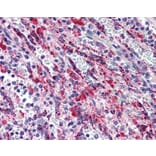 Immunohistochemistry - Anti-TGF beta 1 Antibody (A283195) - Antibodies.com