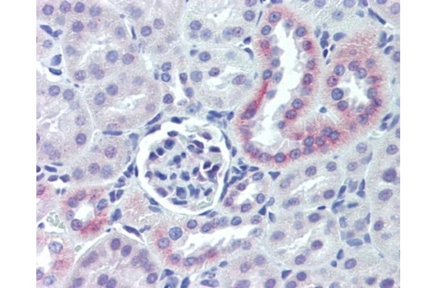 Immunohistochemistry - Anti-Nestin Antibody (A283196) - Antibodies.com