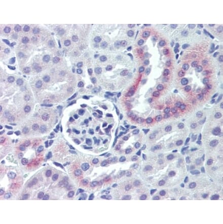 Immunohistochemistry - Anti-Nestin Antibody (A283196) - Antibodies.com