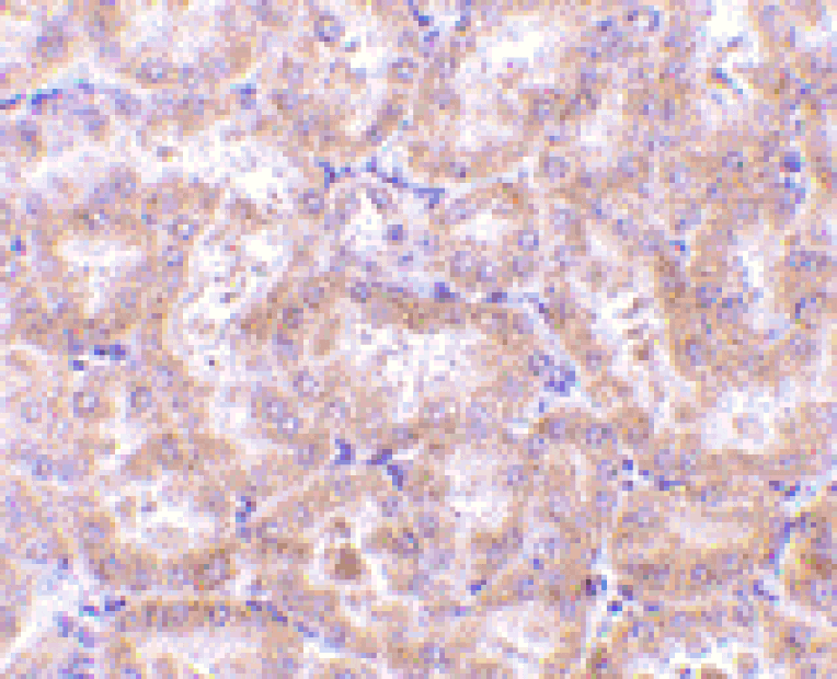 Immunohistochemistry - Anti-RIP3 Antibody (A283221) - Antibodies.com
