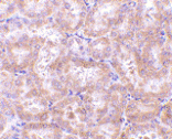 Immunohistochemistry - Anti-RIP3 Antibody (A283221) - Antibodies.com