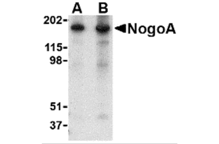 Western Blot - Anti-Nogo Antibody (A283222) - Antibodies.com
