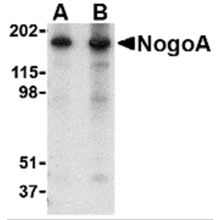 Western Blot - Anti-Nogo Antibody (A283222) - Antibodies.com
