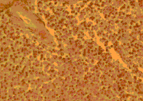 Flow Cytometry - Anti-CCR4 Antibody (A283229) - Antibodies.com