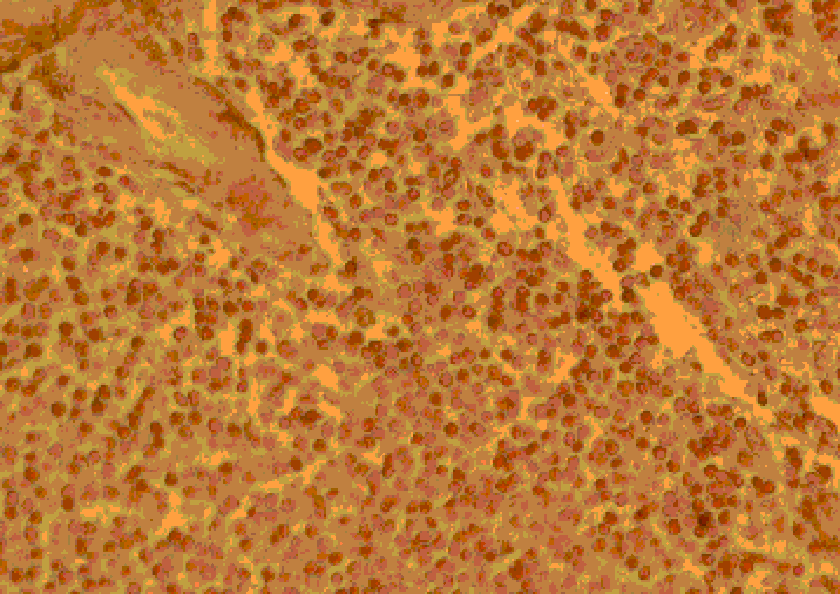 Flow Cytometry - Anti-CCR4 Antibody (A283229) - Antibodies.com