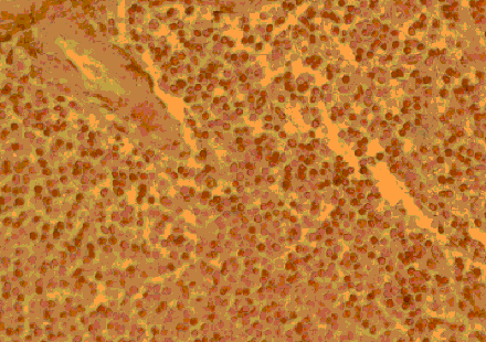 Flow Cytometry - Anti-CCR4 Antibody (A283229) - Antibodies.com