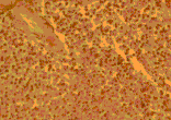 Flow Cytometry - Anti-CCR4 Antibody (A283229) - Antibodies.com