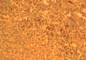 Immunohistochemistry - Anti-CCR2 Antibody (A283230) - Antibodies.com