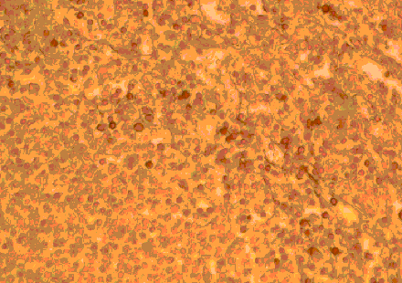 Immunohistochemistry - Anti-CCR2 Antibody (A283230) - Antibodies.com