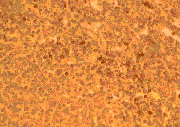 Immunohistochemistry - Anti-CCR2 Antibody (A283230) - Antibodies.com