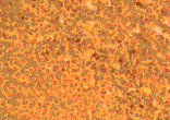 Immunohistochemistry - Anti-CCR2 Antibody (A283230) - Antibodies.com