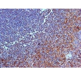 Immunohistochemistry - Anti-IL-23R Antibody (A283237) - Antibodies.com