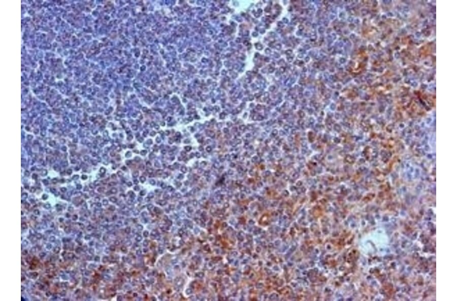 Immunohistochemistry - Anti-IL-23R Antibody (A283237) - Antibodies.com
