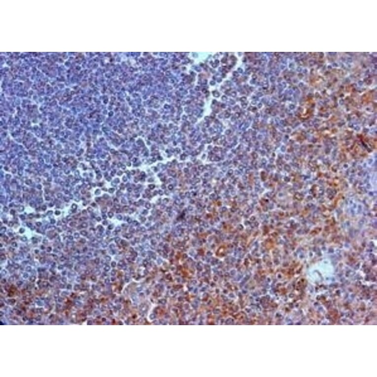 Immunohistochemistry - Anti-IL-23R Antibody (A283237) - Antibodies.com