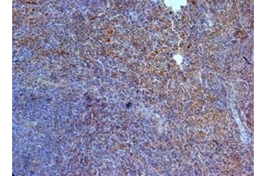Immunohistochemistry - Anti-IL-23R Antibody (A283237) - Antibodies.com
