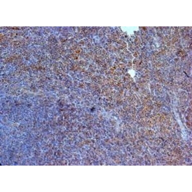 Immunohistochemistry - Anti-IL-23R Antibody (A283237) - Antibodies.com