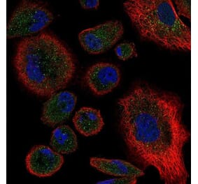 Immunofluorescence  - Anti-TNF Receptor II Antibody - BSA and Azide free (A283246) - Antibodies.com