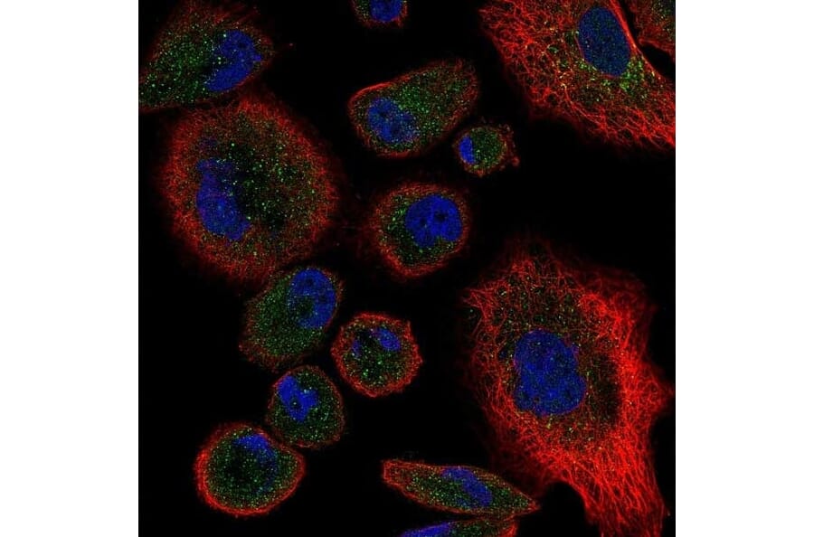Immunofluorescence  - Anti-TNF Receptor II Antibody - BSA and Azide free (A283246) - Antibodies.com