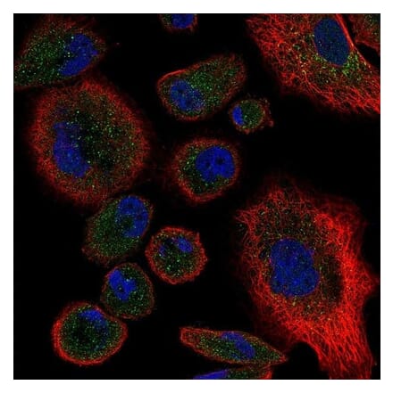 Immunofluorescence  - Anti-TNF Receptor II Antibody - BSA and Azide free (A283246) - Antibodies.com