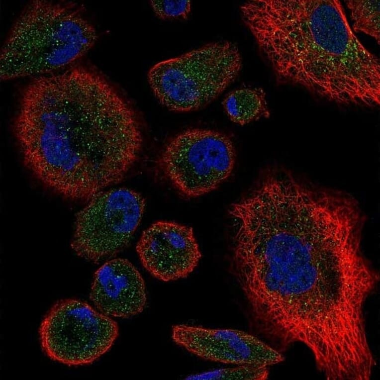 Immunofluorescence  - Anti-TNF Receptor II Antibody - BSA and Azide free (A283246) - Antibodies.com