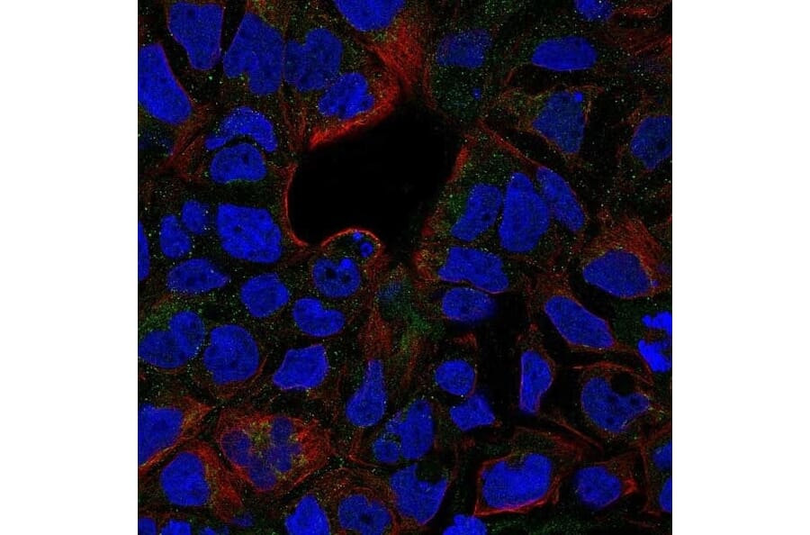 Immunofluorescence  - Anti-TNF Receptor II Antibody - BSA and Azide free (A283246) - Antibodies.com