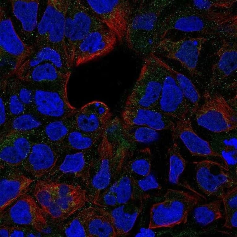 Immunofluorescence  - Anti-TNF Receptor II Antibody - BSA and Azide free (A283246) - Antibodies.com
