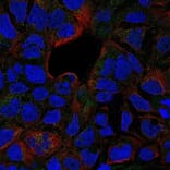 Immunofluorescence  - Anti-TNF Receptor II Antibody - BSA and Azide free (A283246) - Antibodies.com