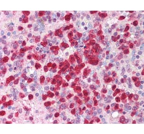Immunohistochemistry - Anti-IL-21 Antibody (A283248) - Antibodies.com