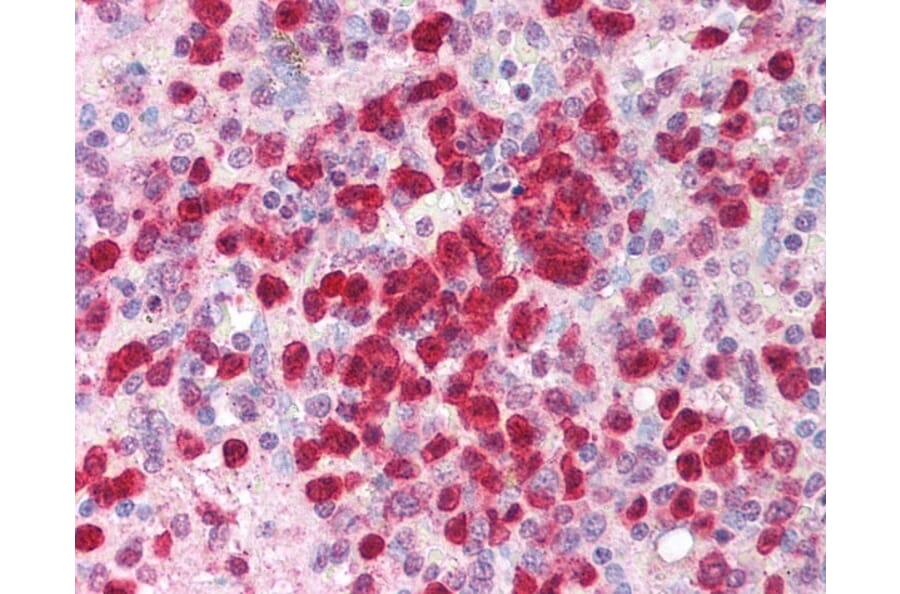 Immunohistochemistry - Anti-IL-21 Antibody (A283248) - Antibodies.com