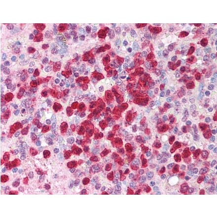 Immunohistochemistry - Anti-IL-21 Antibody (A283248) - Antibodies.com