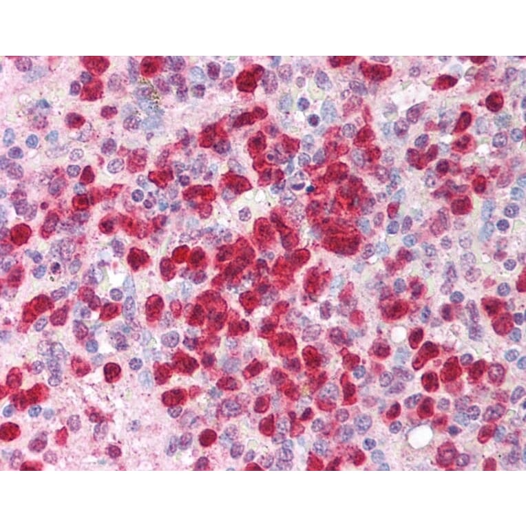 Immunohistochemistry - Anti-IL-21 Antibody (A283248) - Antibodies.com