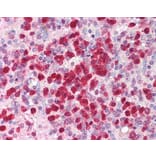 Immunohistochemistry - Anti-IL-21 Antibody (A283248) - Antibodies.com
