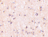 Immunohistochemistry - Anti-IRGM Antibody (A283257) - Antibodies.com