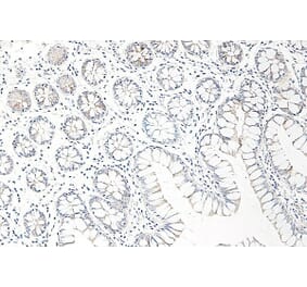 Immunohistochemistry - Anti-CCL25 Antibody - BSA and Azide free (A283268) - Antibodies.com
