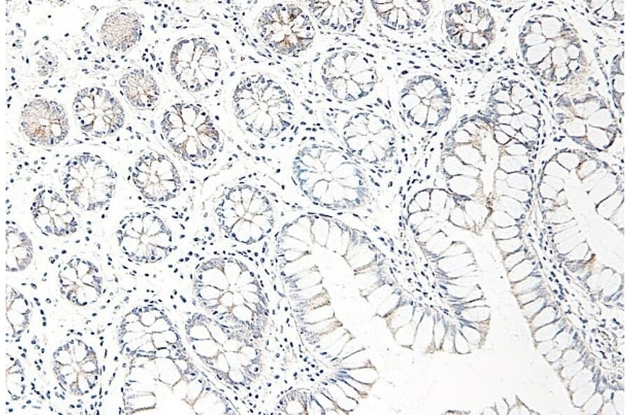Immunohistochemistry - Anti-CCL25 Antibody - BSA and Azide free (A283268) - Antibodies.com