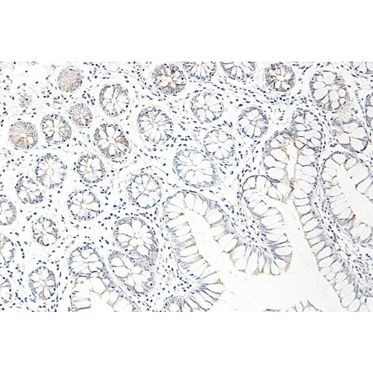 Immunohistochemistry - Anti-CCL25 Antibody - BSA and Azide free (A283268) - Antibodies.com
