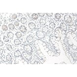 Immunohistochemistry - Anti-CCL25 Antibody - BSA and Azide free (A283268) - Antibodies.com