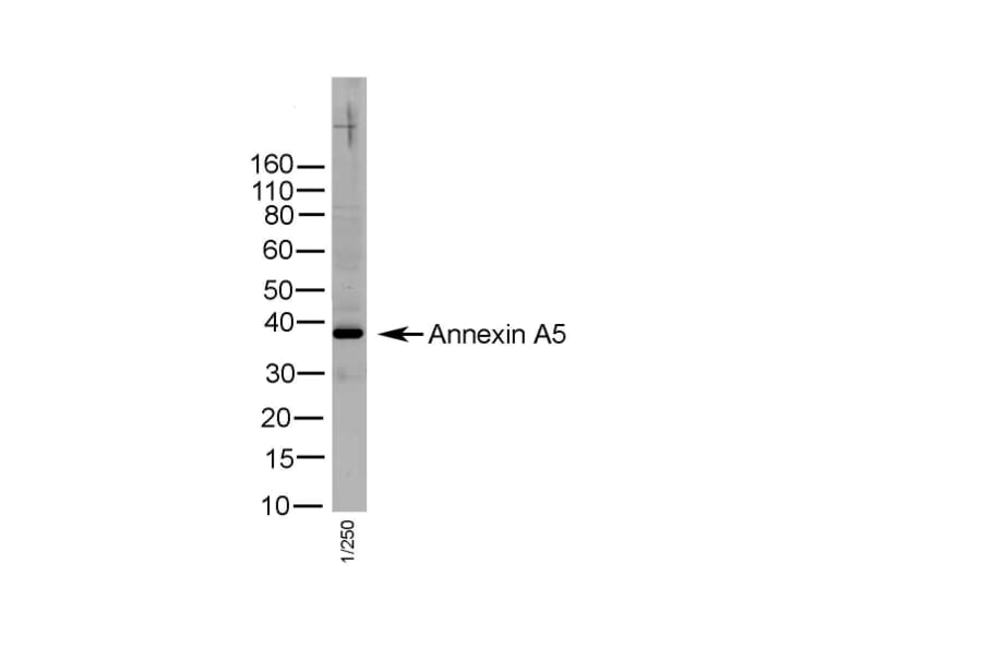 Immunohistochemistry - Anti-Annexin V / ANXA5 Antibody (A283269) - Antibodies.com