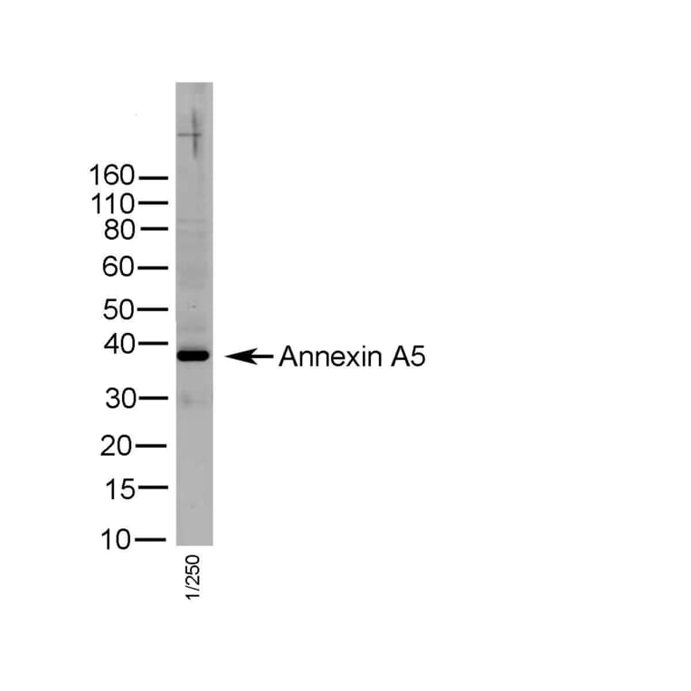 Immunohistochemistry - Anti-Annexin V / ANXA5 Antibody (A283269) - Antibodies.com