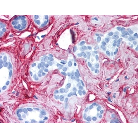 Immunohistochemistry - Anti-Collagen VI Antibody (A283274) - Antibodies.com