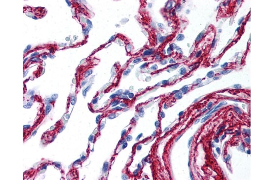 Immunohistochemistry - Anti-Collagen VI Antibody (A283274) - Antibodies.com