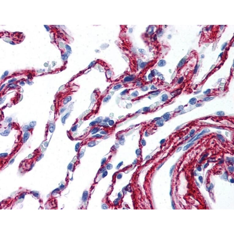 Immunohistochemistry - Anti-Collagen VI Antibody (A283274) - Antibodies.com