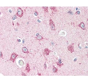 Immunohistochemistry - Anti-CRTH2 Antibody (A283294) - Antibodies.com