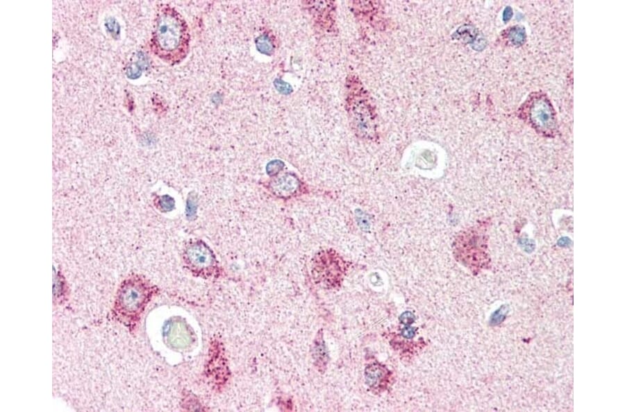 Immunohistochemistry - Anti-CRTH2 Antibody (A283294) - Antibodies.com