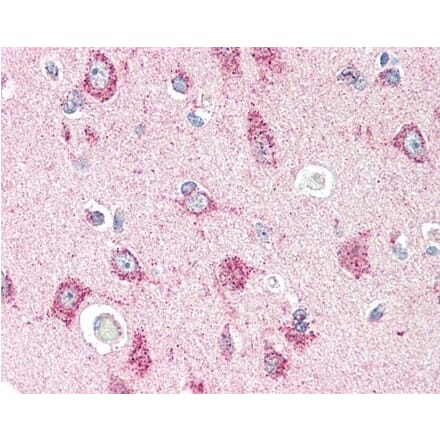 Immunohistochemistry - Anti-CRTH2 Antibody (A283294) - Antibodies.com