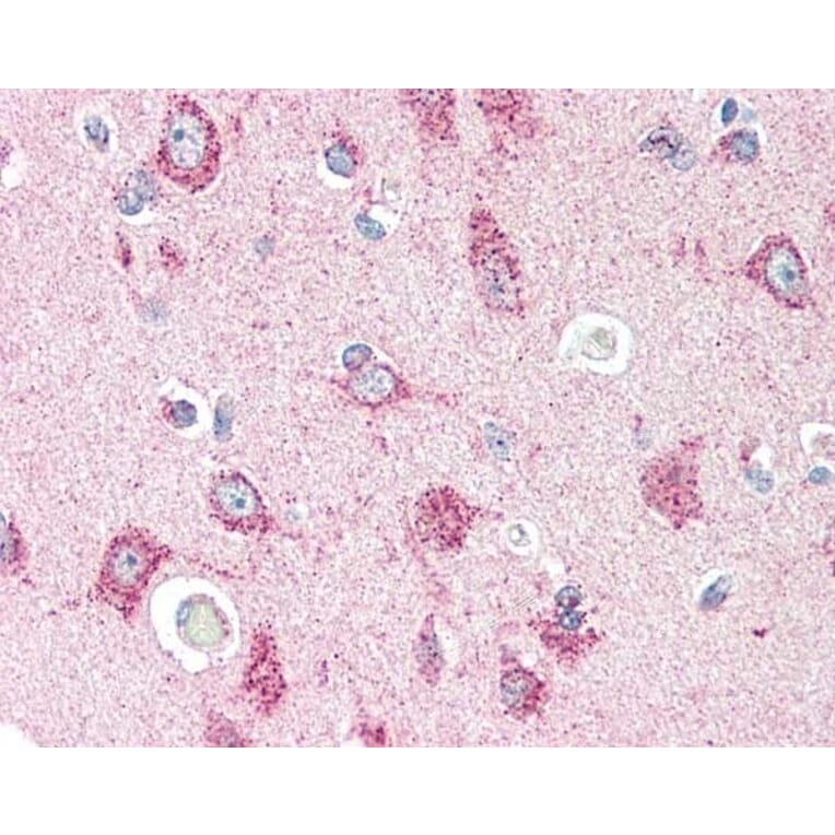 Immunohistochemistry - Anti-CRTH2 Antibody (A283294) - Antibodies.com