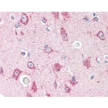 Immunohistochemistry - Anti-CRTH2 Antibody (A283294) - Antibodies.com